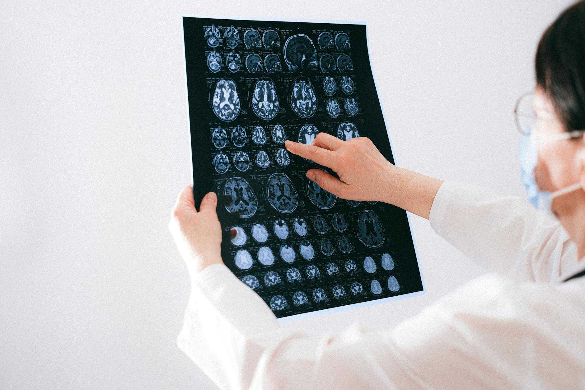 doctor pointing to an mri scan